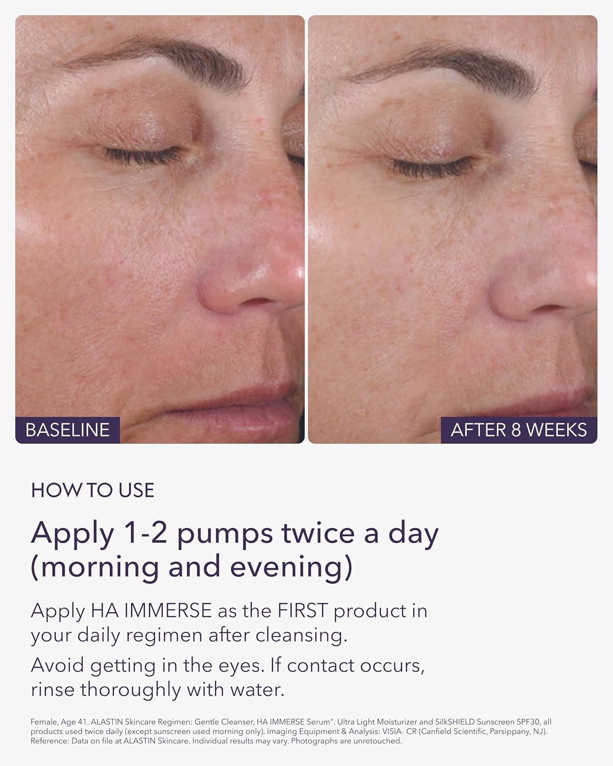 ALASTIN Skincare Hyaluronic Acid HA IMMERSE Moisturizing Face Serum (1 oz) | Restorative Serum Combats Dry, Dehydrated Skin | For Radiant, Glowing Skin