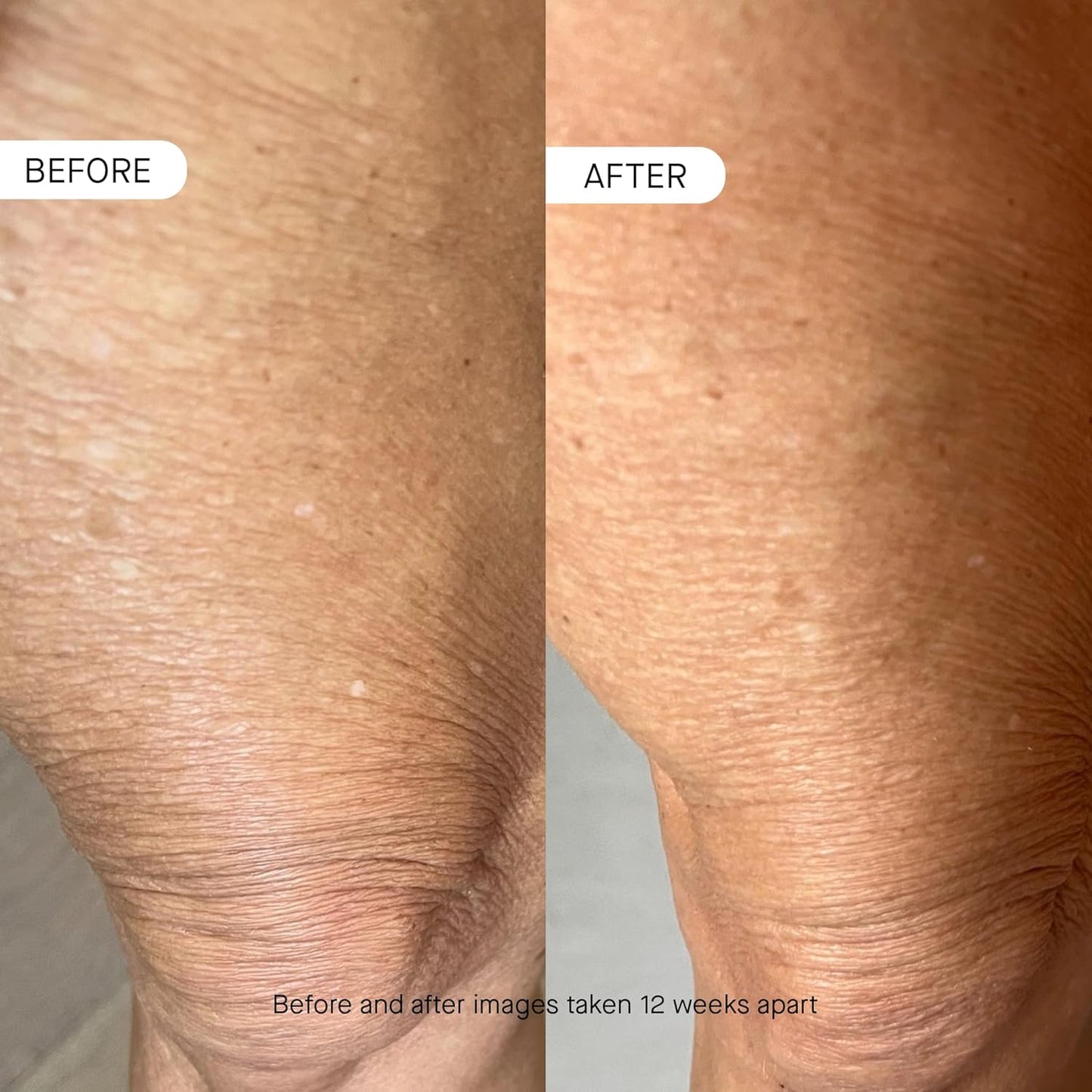 OneSkin BODY OS-01 Peptide Skin Longevity Daily Moisturizer- Improves Skin Texture & Barrier, Safe for Sensitive Skin