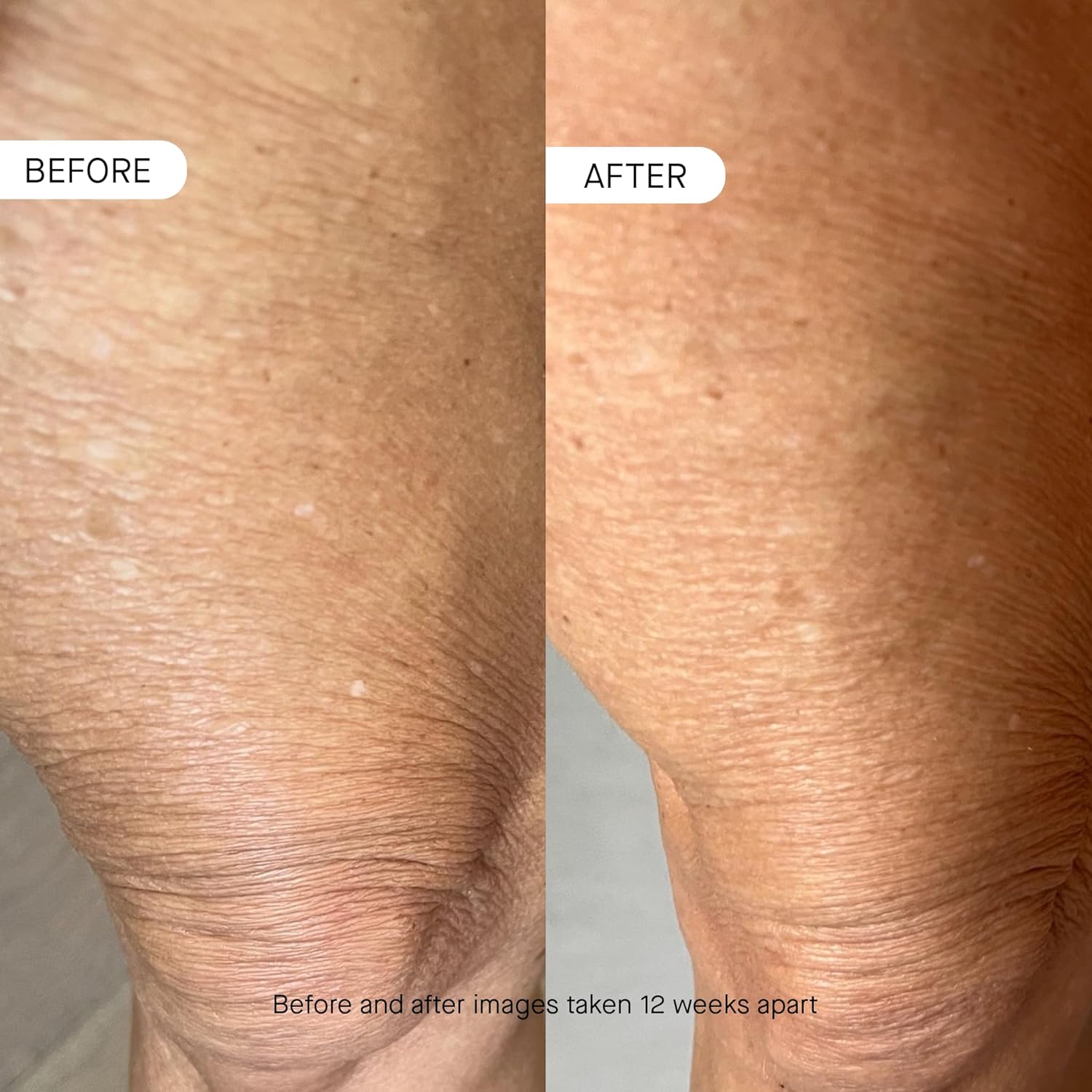 OneSkin BODY OS-01 Peptide Skin Longevity Daily Moisturizer- Improves Skin Texture & Barrier, Safe for Sensitive Skin